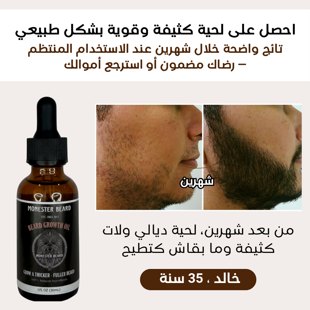 Monster Beard™ – الحلّ المثالي لإنبات اللحية وملء الفراغات بفعالية